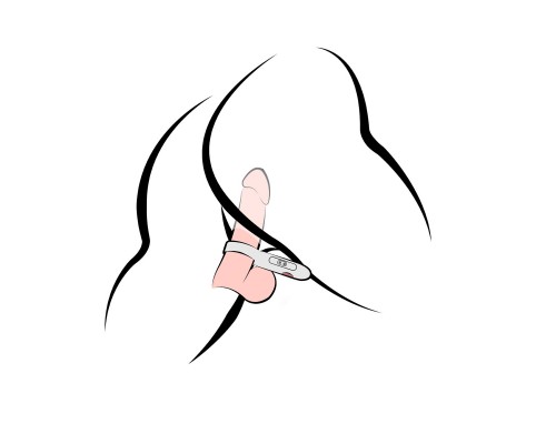 Эрекционное виброкольцо